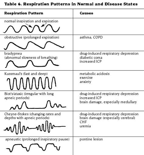 Cheyne Stokes Respirations Are Described as a