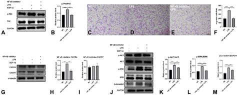 P Gingivalis Lps Can Promote Migration Of Pdlsc Towards Sdf 1α Through