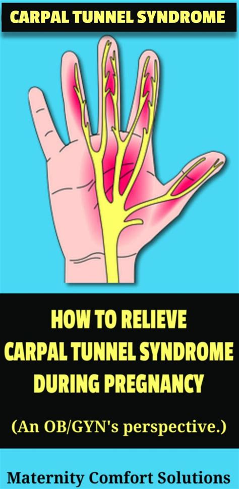 How To Relieve Carpal Tunnel Symptoms During Pregnancy - PregnancyWalls