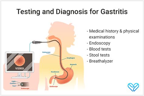 Gastritis Causes Symptoms Diagnosis Treatment And More