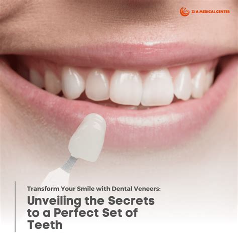 dental veneer teeth treatment dubai veneer placement dubai dentist