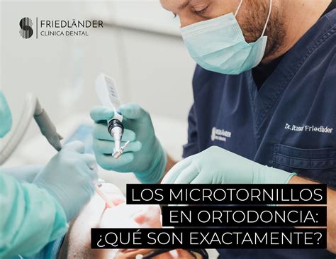 Microtornillos En Ortodoncia Qu Es Cl Nica Friedl Nder