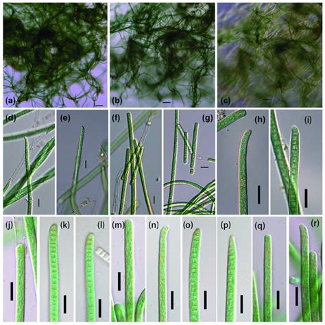 light microscopy  phormidium  sp  strains   represent