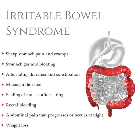 Stool Mucus Colon Cancer Symptoms