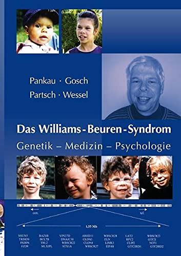 Das Williams Beuren Syndrom By Unknown Author Goodreads