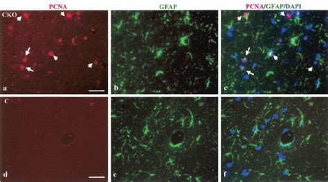 Increased Astrocyte Number In The Brains Of Nf1 GFAP CKO Mice Is The