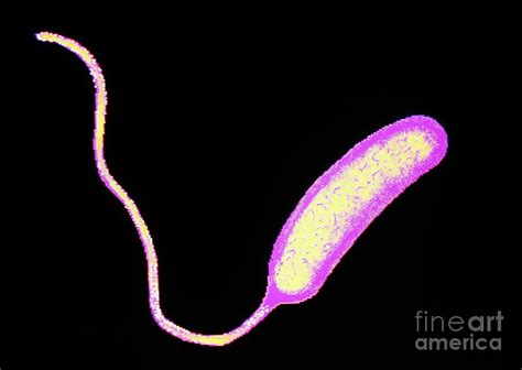 Cholera Bacteria Shape