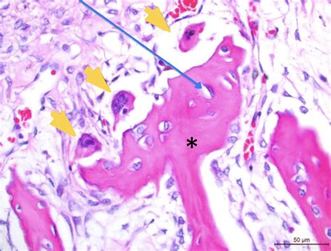 Bone Pathology I Flashcards Quizlet