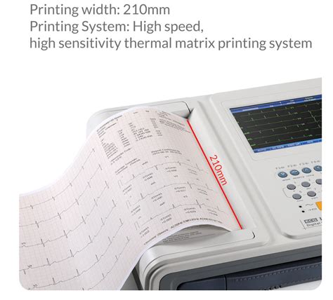 Electrocardiógrafo Carewell ECG 1112M PortalHealth