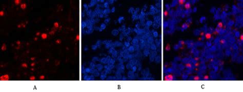 臻品一抗 Cleaved Caspase 3抗体推荐 每日生物评论