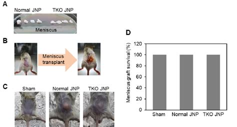 Procedures For Meniscus Transplantation Of Normaltko Jnp And Graft