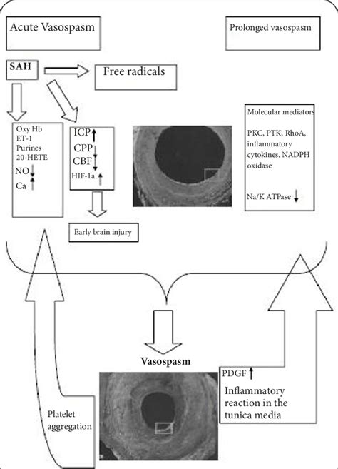 Humoral And Molecular Mechanisms Of Cerebral Vasospasm In Patients With