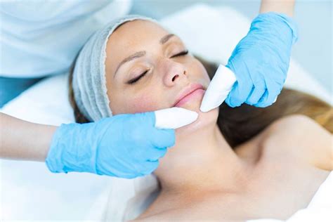 Australias Best Acne Treatment For You Perfect Laser Clinics