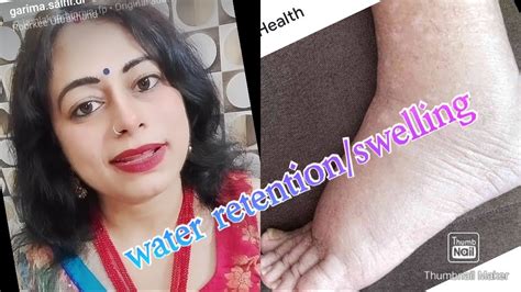 Swellingwater Retention Kyugarima10109 Youtube