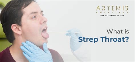 What Is Strep Throat Symptoms Causes And Treatments