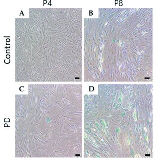 Cell Senescence Evaluated By Galactosidase Sa Gal Staining At