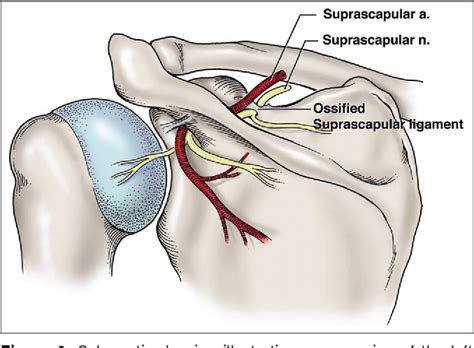 Transverse Scapular Ligament