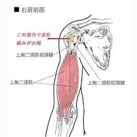 肩や二の腕の痛みの原因は？上腕二頭筋長頭腱炎の症状・対処法を解説！ Style Up Gym Charisfitのブログ