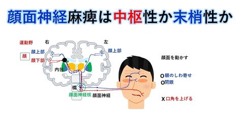 国試対策暗記からの卒業 68話 顔面神経麻痺 Youtube