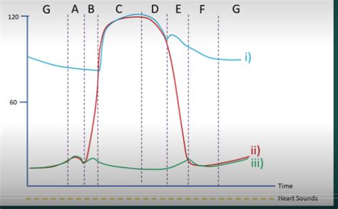 Cardiac Cycle Diagram Diagram | Quizlet