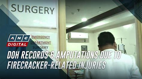 DOH Records 6 Amputations Due To Firecracker Related Injuries ANC