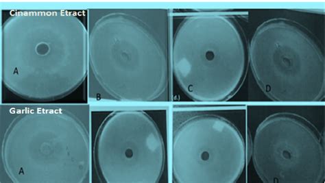 Inhibitory Activity Of The Different Solvent Extracts Of Cinnamon And