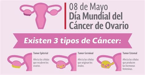 Día Mundial del Cáncer de Ovario DMI Diagnóstico Médico por Imágenes