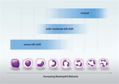 Leukocytosis Meaning Leukocytosis Define Types Of Leukocytes 21180 ...