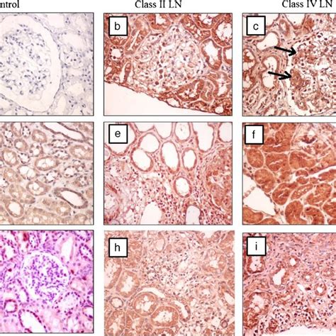 Immunohistochemical staining of IFN γ in control a d g class II