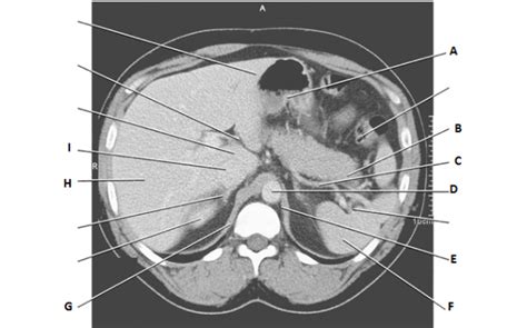 abdpelvis diagram quizlet