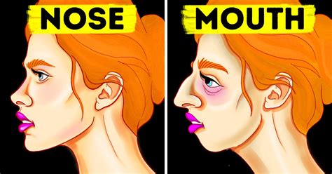 How To Fix Mouth Breather Face (Adenoid Face): Does Mouth Breathing Change Your Face Shape?