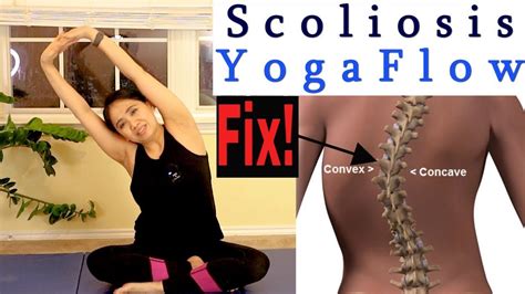 Top 10 Effective Yoga Poses For Cervical Spondylosis In Fit And Health