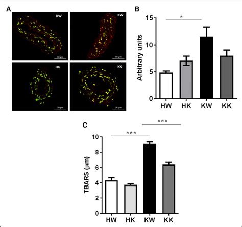 Oxidative Stress Is Abolished In Microvessels Of Dbdb Mice With Nox1