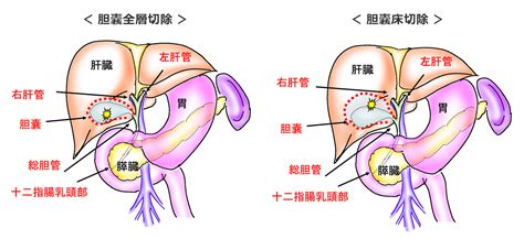 肝臓・胆道・膵臓 山口大学大学院医学系研究科 消化器・腫瘍外科学