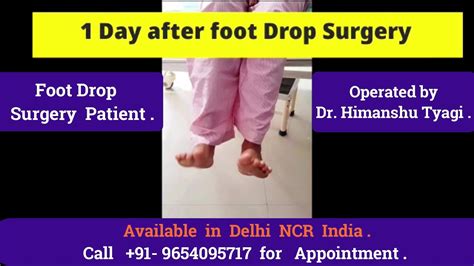 Foot Drop Surgery Patient St Day Recovery Youtube