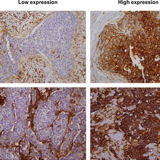 Representative images of immunostaining with human leukocyte antigen ...