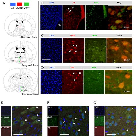 Co Localization Of Ar Gnrh And Crh In Mpo Neurons Determined By