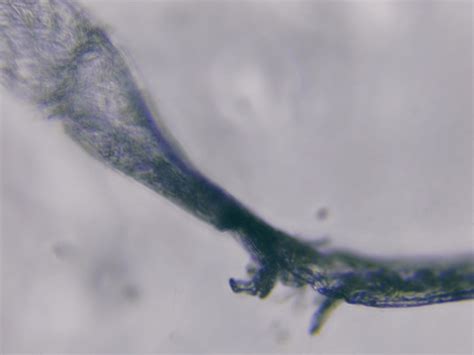 lyme pathogens      shapes views