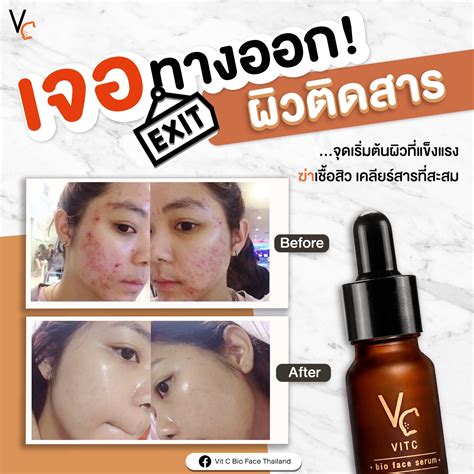 Ratcha Vit C Bio Face Serum รัชชาเซรั่ม วิตซี Nongchat Makeup