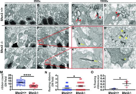 Electron Microscopy Analysis Of Ribbon Synapses In The Outer Plexiform