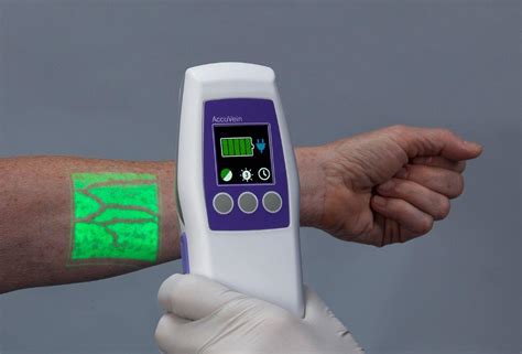 Vein Finder Accuvein Av Vein Viewing System