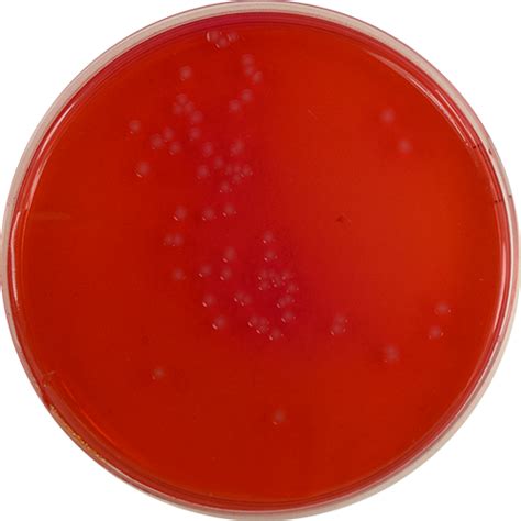 Xylose Lysine Deoxycholate Xld Agar With Novobiocin Mg L E