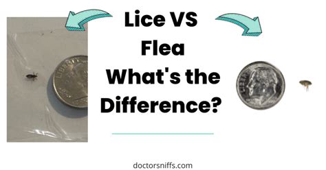 Lice VS Flea - Comparison: Friendly Guide to Pest Differences