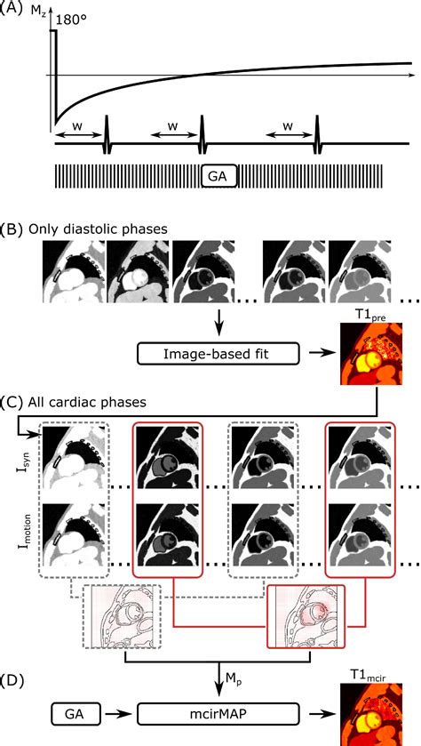 Motion‐corrected Model‐based Reconstruction For 2d Myocardial T1