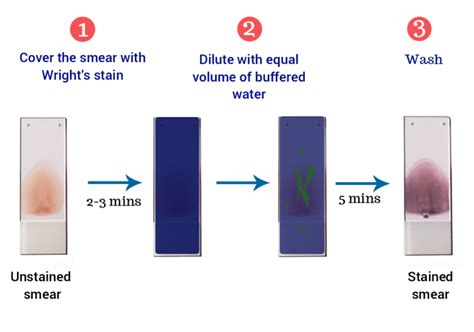 Wright S Stain Preparation Principle Procedure And Results