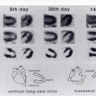 Pet And Bmipp Mages Ver Tical Long Axis And Transaxial Slices