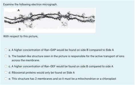 Solved Examine The Following Electron Micrograph A B With Chegg