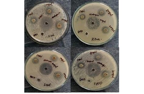 Visual Evidence Of The Zone Of Inhibition Of Zno Nps Against Four