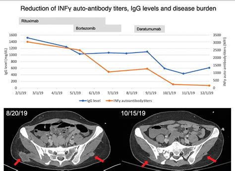 Figure 1 From Daratumumab Anti CD38 For Treatment Of Disseminated