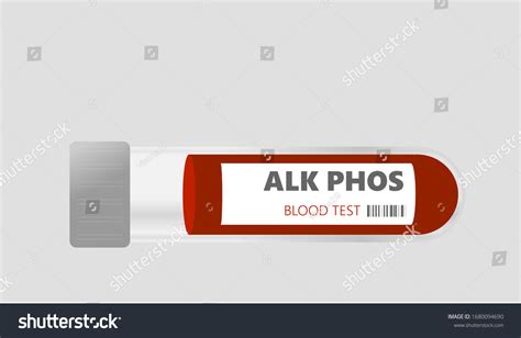 152 Alkaline phosphatase Images, Stock Photos & Vectors | Shutterstock